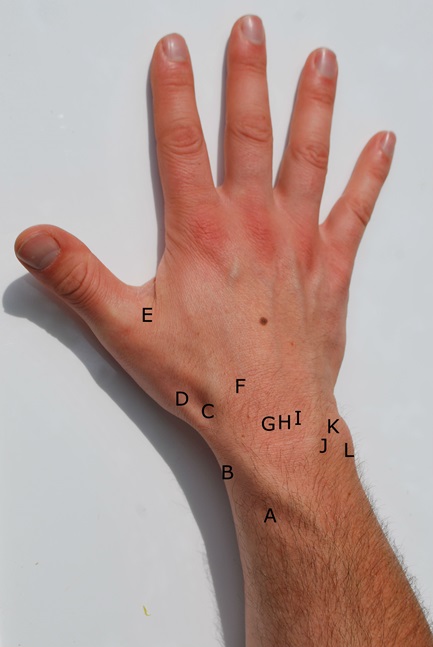 Photograph of the back of the hand and wrist, with points A to L marking common sites of dorsal wrist pain